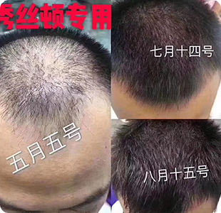 华人策略研究论坛