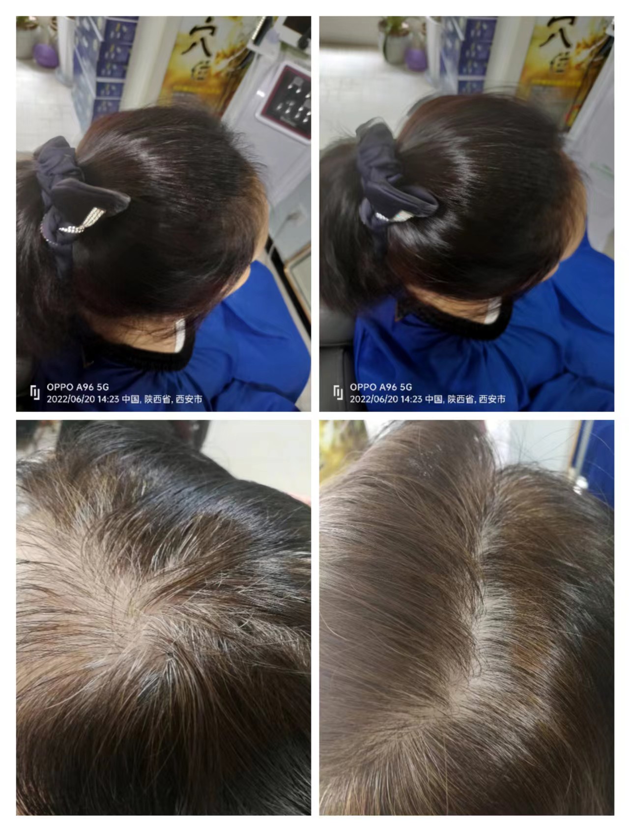 植物养发连锁加盟