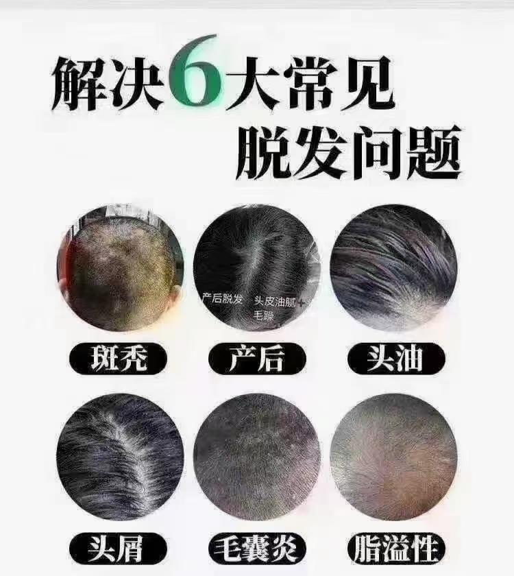 中药头疗连锁加盟