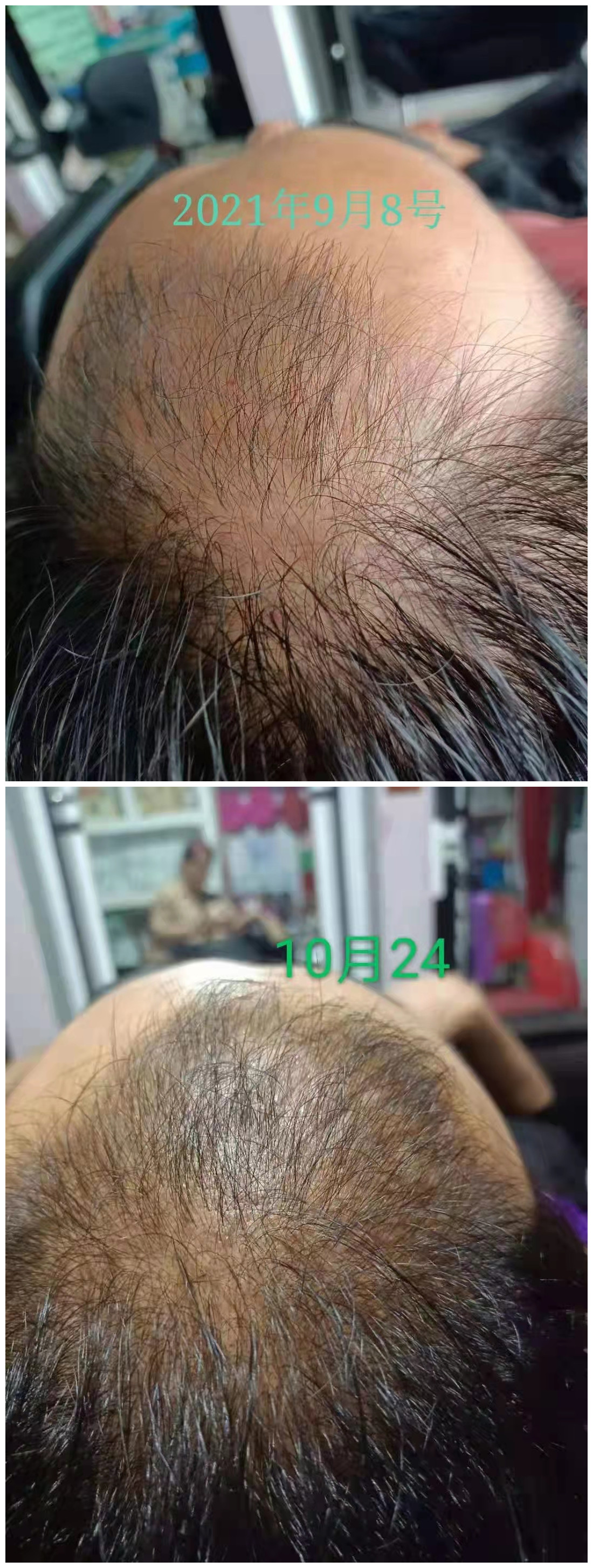 秀丝顿植物养发解决头发所有苦恼问题