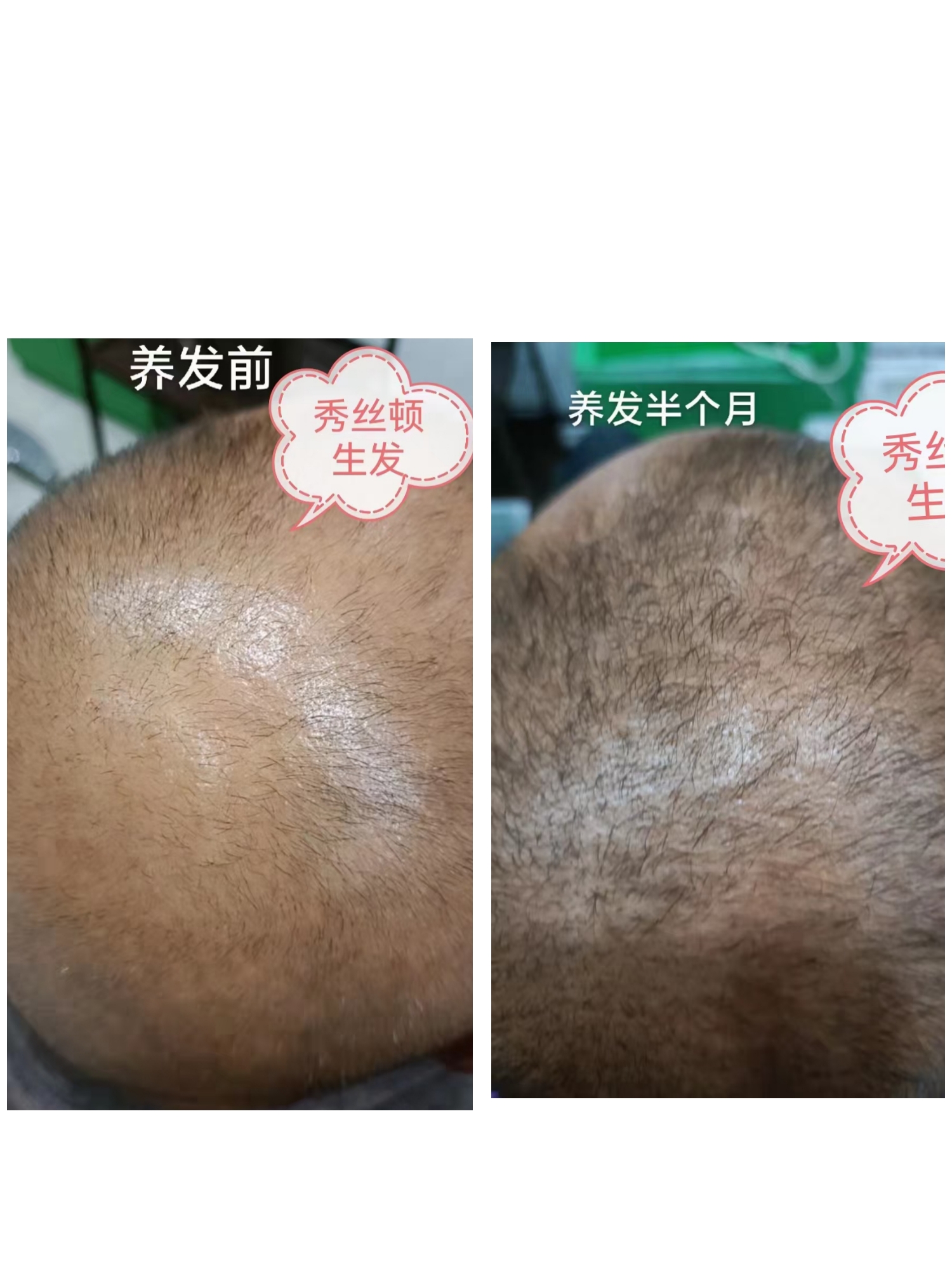 秀丝顿植物养发健康时尚无伤害