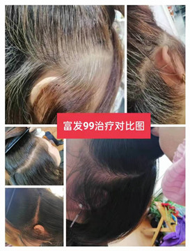 秀丝顿植物养发天然植物成分，通过科学配比，深入滋养头皮，激活毛囊