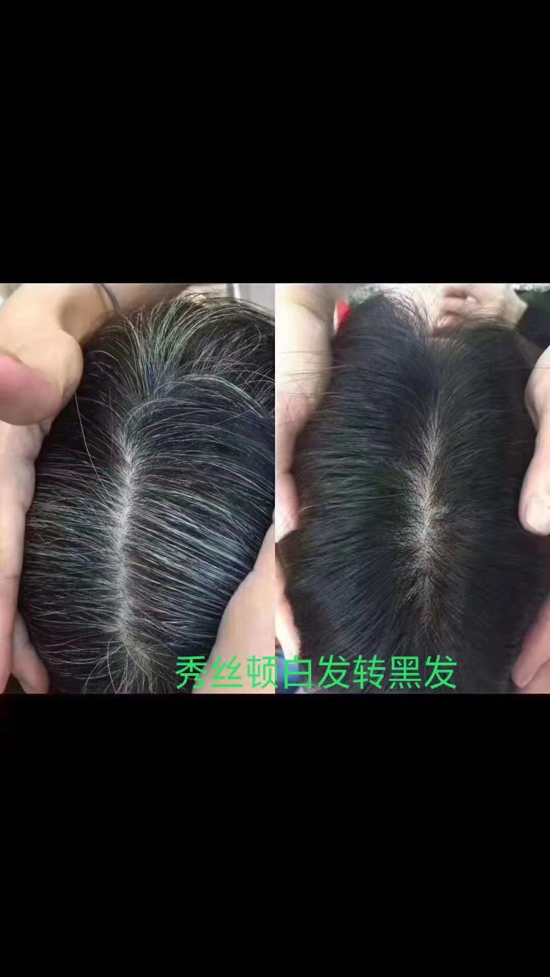 秀丝顿植物染发是一种全新的染发方式，它使用天然的植物材料来染发。这种染发方式安全无伤害
