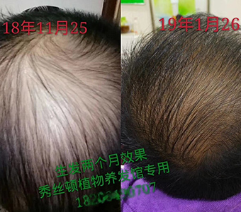 秀丝顿植物养发 郑州店头疗很舒服