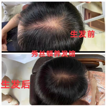 秀丝顿植物养发连锁加盟代理