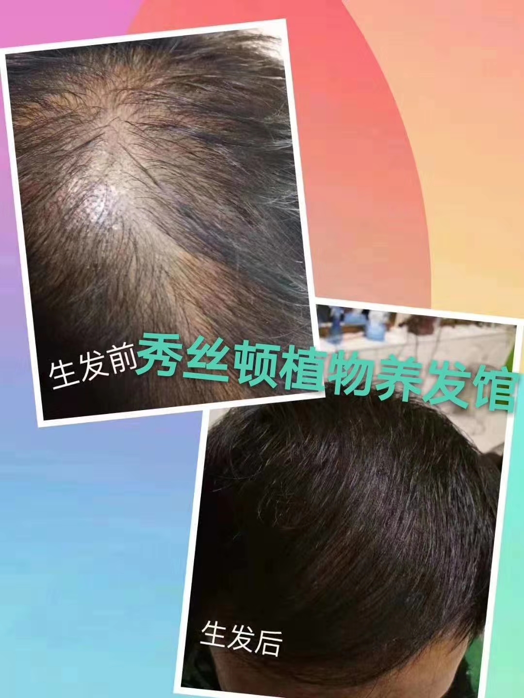 秀丝顿植物养发加盟连锁郑州店生发15天见效