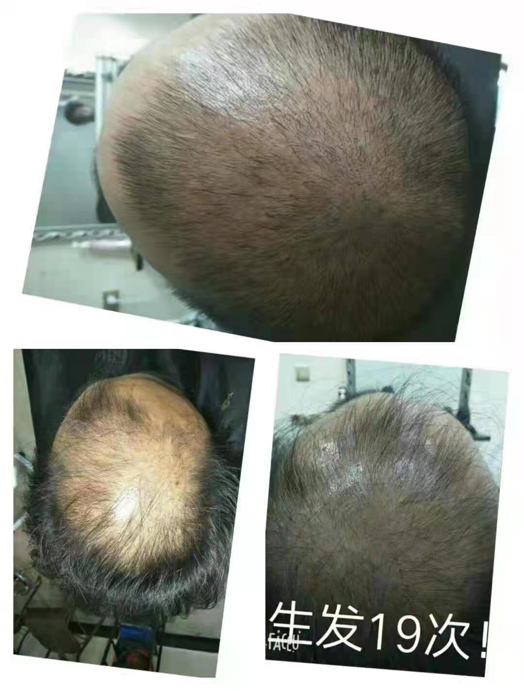 秀丝顿植物养发招商代理