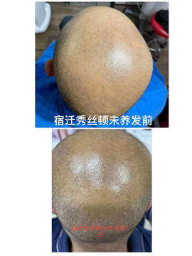 秀丝顿植物养发能够有效地解决你的白发问题