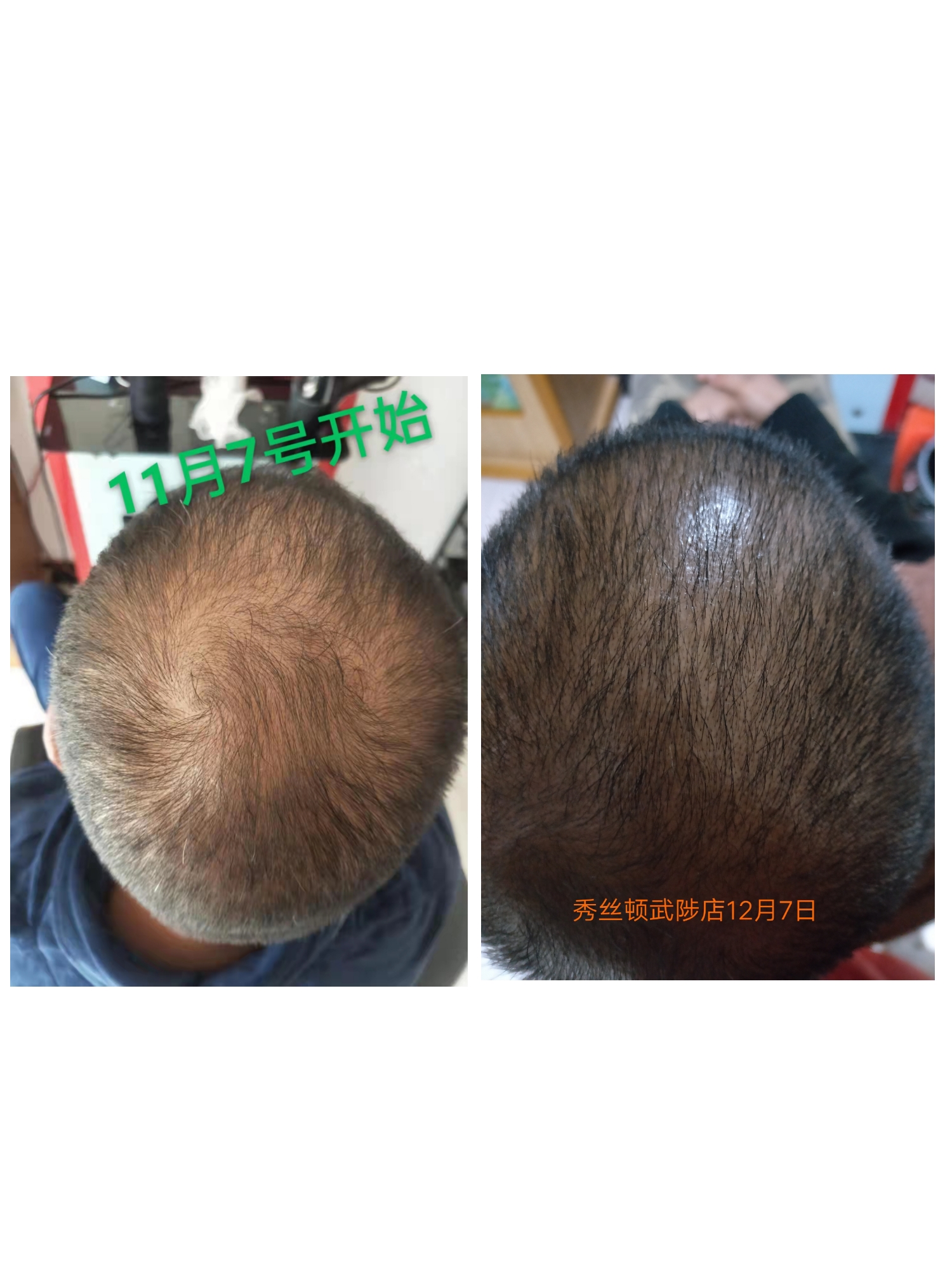 秀丝顿植物养发让你的发质更加健康、柔顺