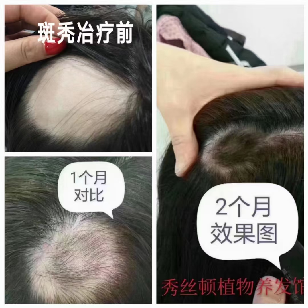 秀丝顿植物养发采用天然植物提取物，不含任何化学成分，安全可靠。