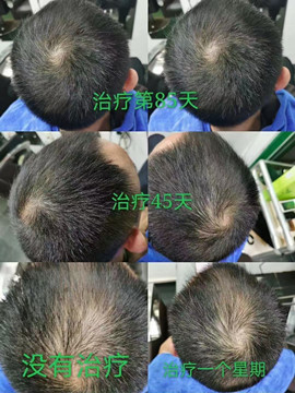 秀丝顿植物养发全国连锁加盟，为您提供专业的养发服务，让您的头发焕发出自然、健康的光彩