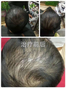 秀丝顿植物养发利用植物的精华来滋养头发