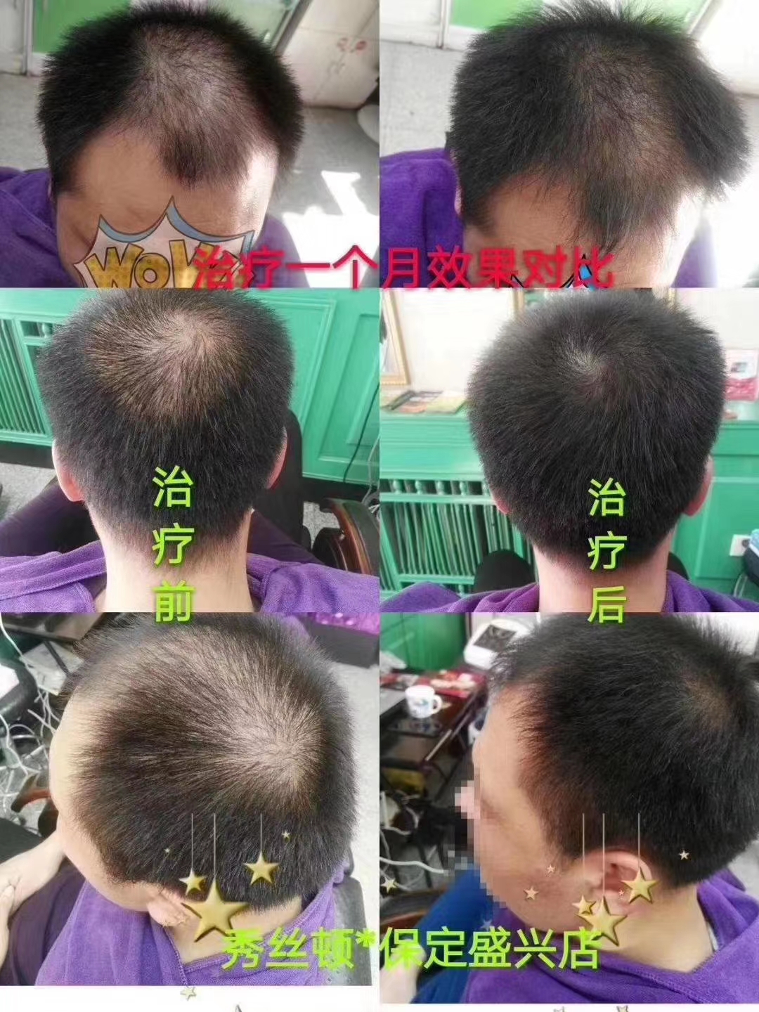 秀丝顿植物养发是一种安全、高效、无刺激的养发产品