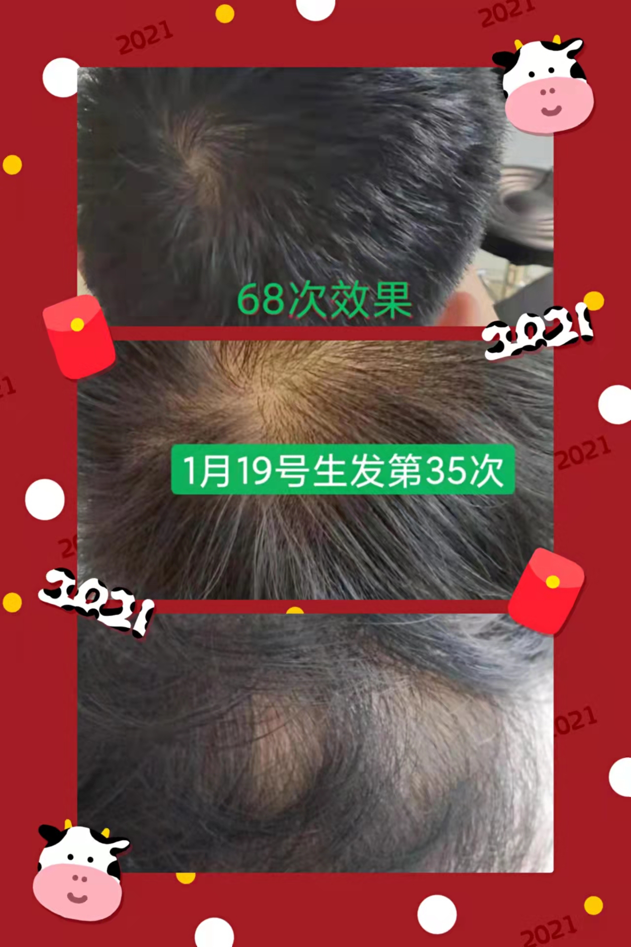 秀丝顿植物染发采用纯天然植物成分，不含有任何化学添加剂，对头发无伤害
