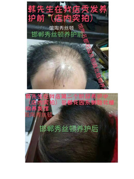 秀丝顿植物养发馆 头部理疗就是在头部反射区按摩头部达到预防和治疗疾病目的一种方法