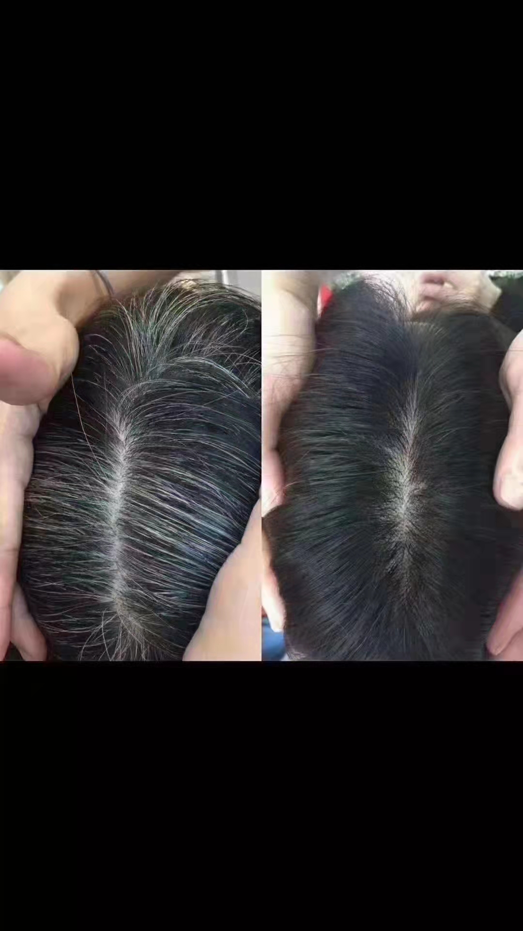 秀丝顿植物养发是头皮毛囊清爽干净防止头油头屑脱发形成，是头发呈现自然乌黑光亮。