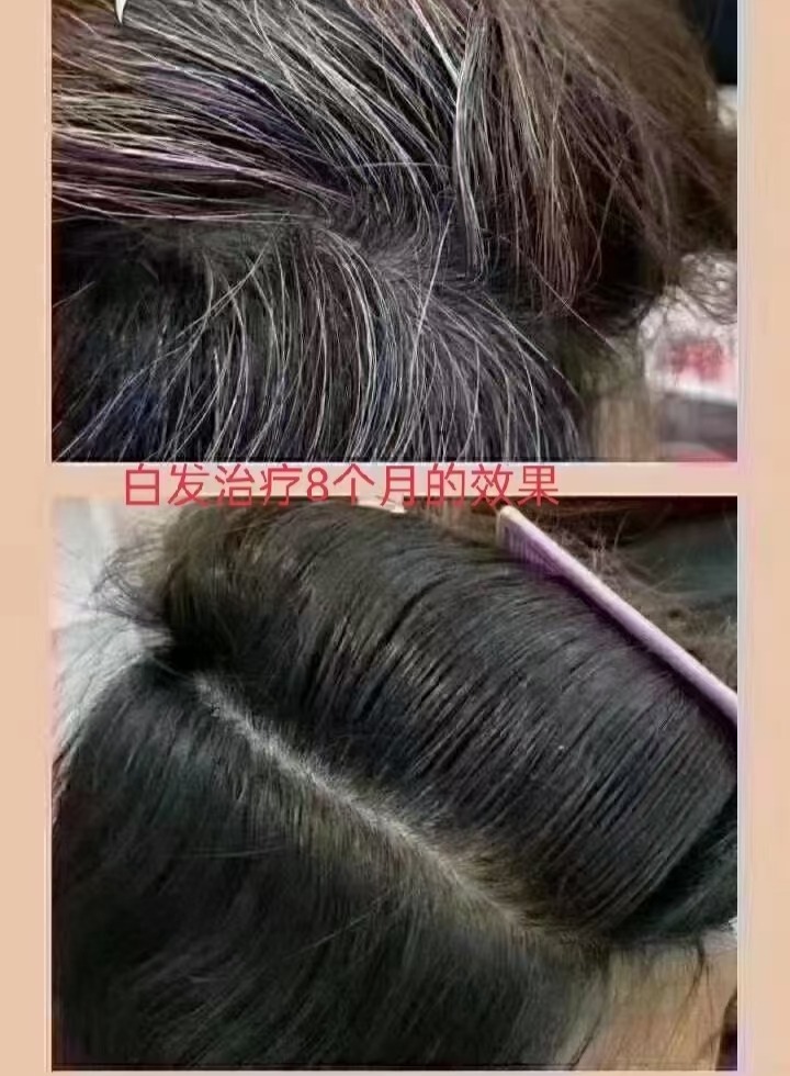 秀丝顿植物养发馆是指专门为人们提供养疗修复头发的场所