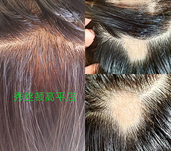 秀丝顿植物养发头部理疗改善睡眠，重现健康活力