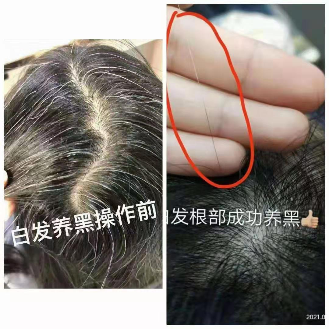 秀丝顿植物养发的理念是“清、调、补”唤醒毛囊自身的生命力