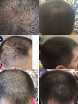 秀丝顿植物养发按摩，刮痧，梳疗等方法起到全身保健的作用