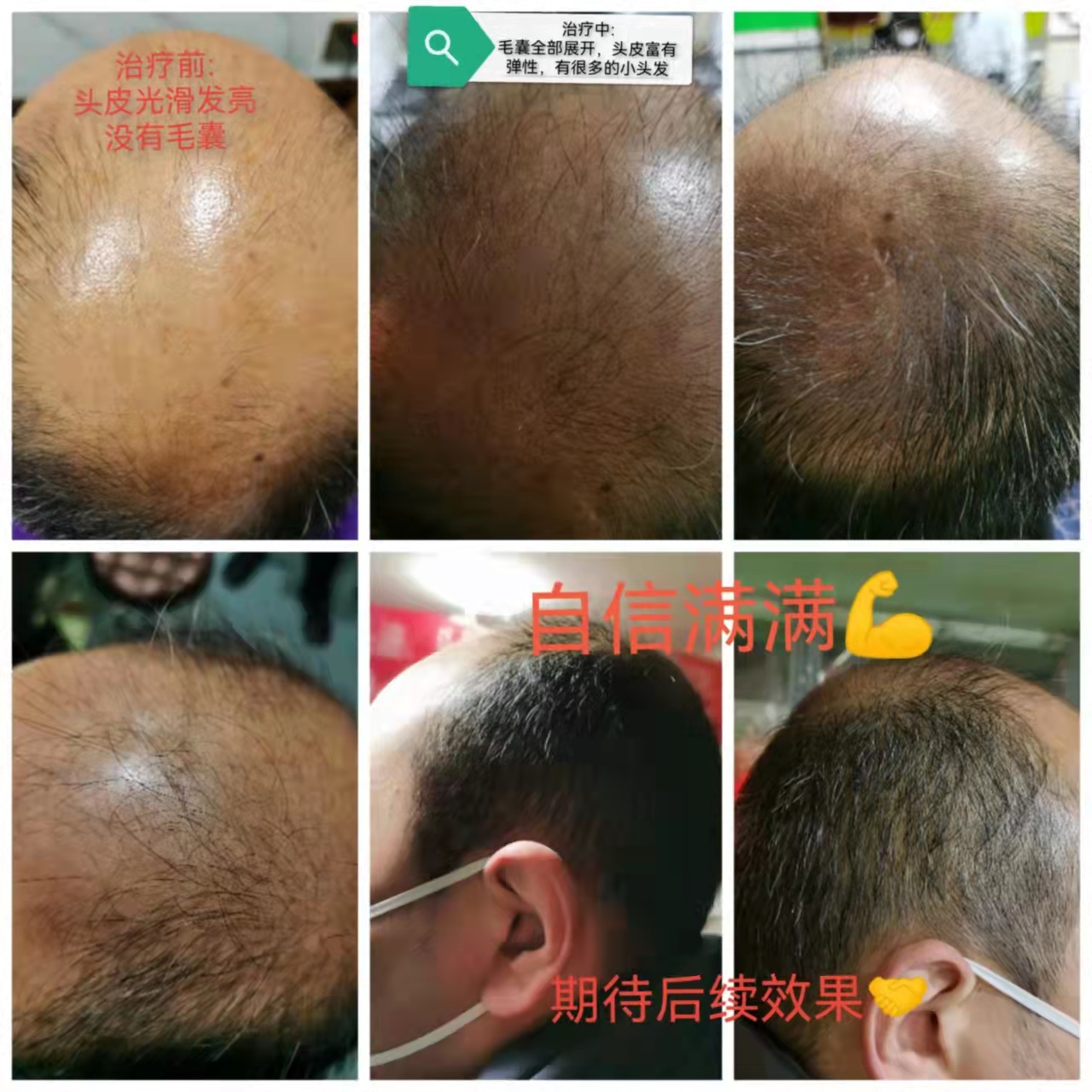 秀丝顿植物养发，时尚健康自然自信。让我们一起保护环境，爱护自己，选择自然植物养发。