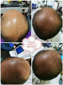 秀丝顿养发馆是华人策略研究论坛旗下品牌之一，全国1000多家加盟店