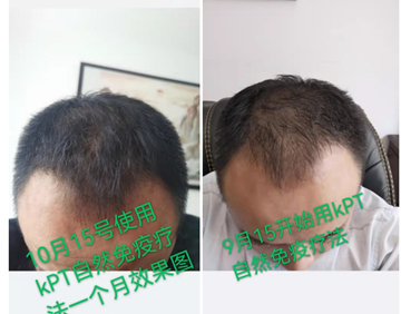 秀丝顿植物养发防脱育发，采用天然植物成分，针对头发问题进行根源性解决