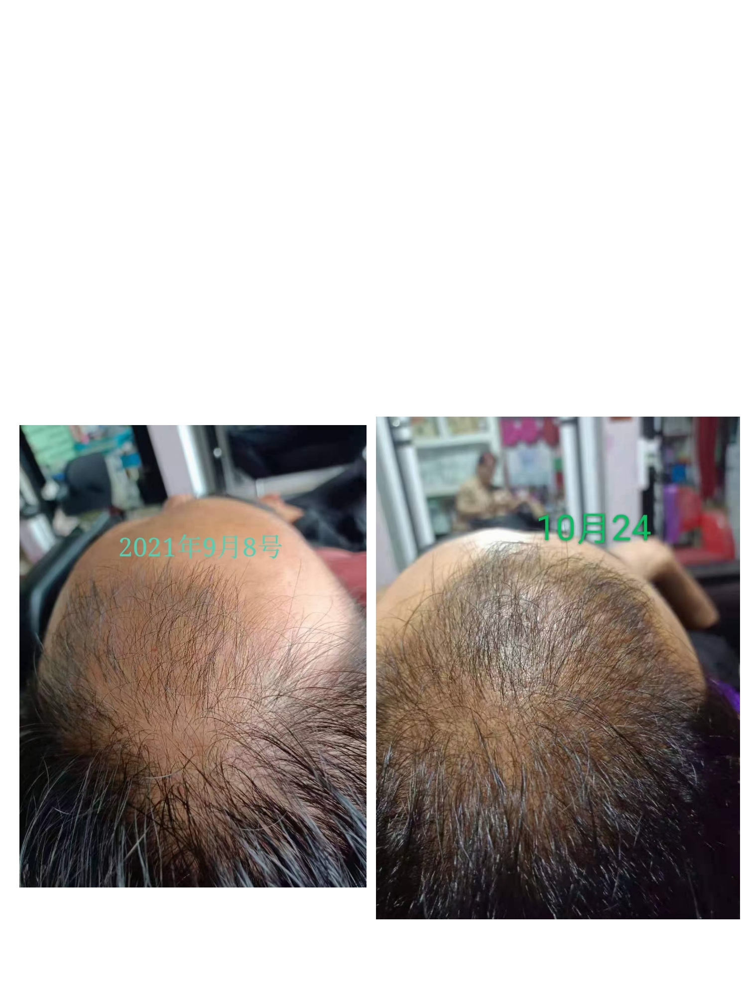 秀丝顿植物染发不仅是一种全新的染发方式，更是一种健康的生活方式