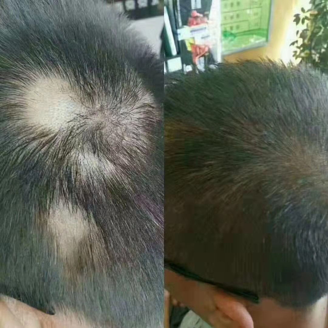 秀丝顿植物染发是一种全新的染发方式