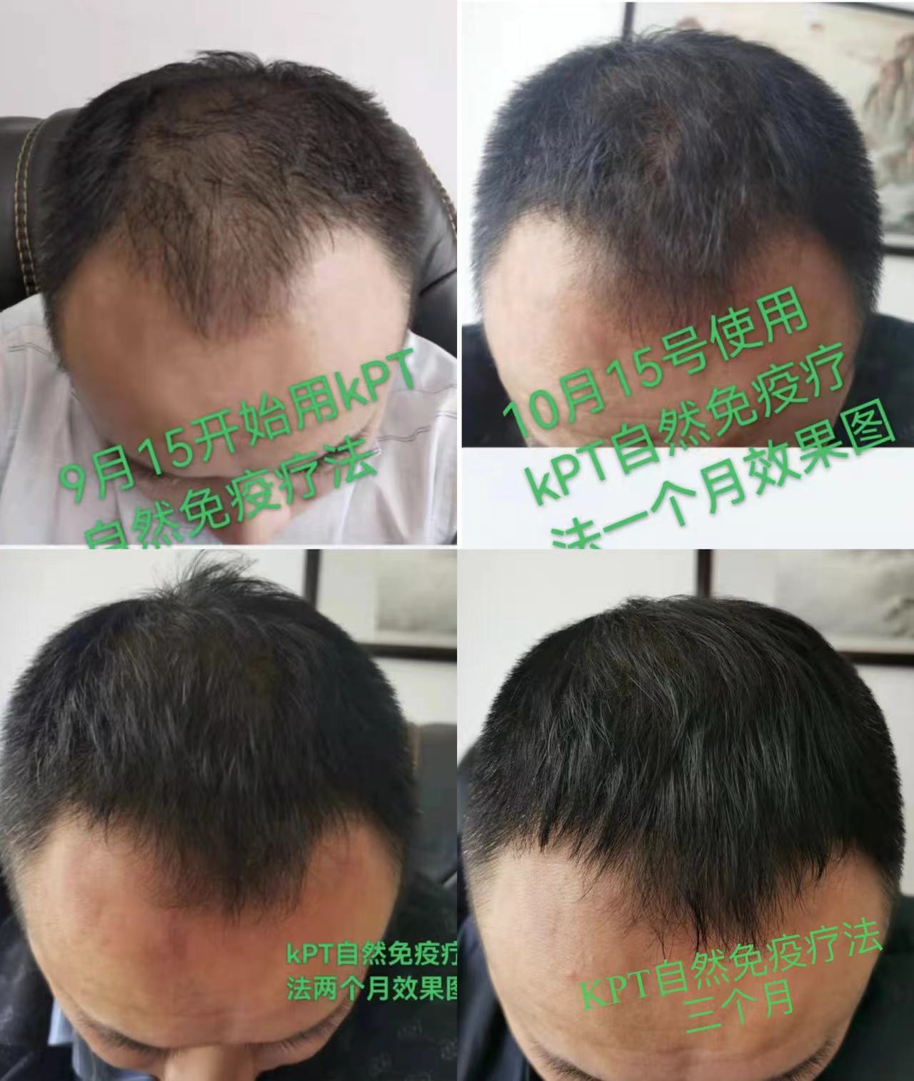 秀丝顿植物养发，时尚健康自然自信。让我们一起保护环境，爱护自己，选择自然植物养发。
