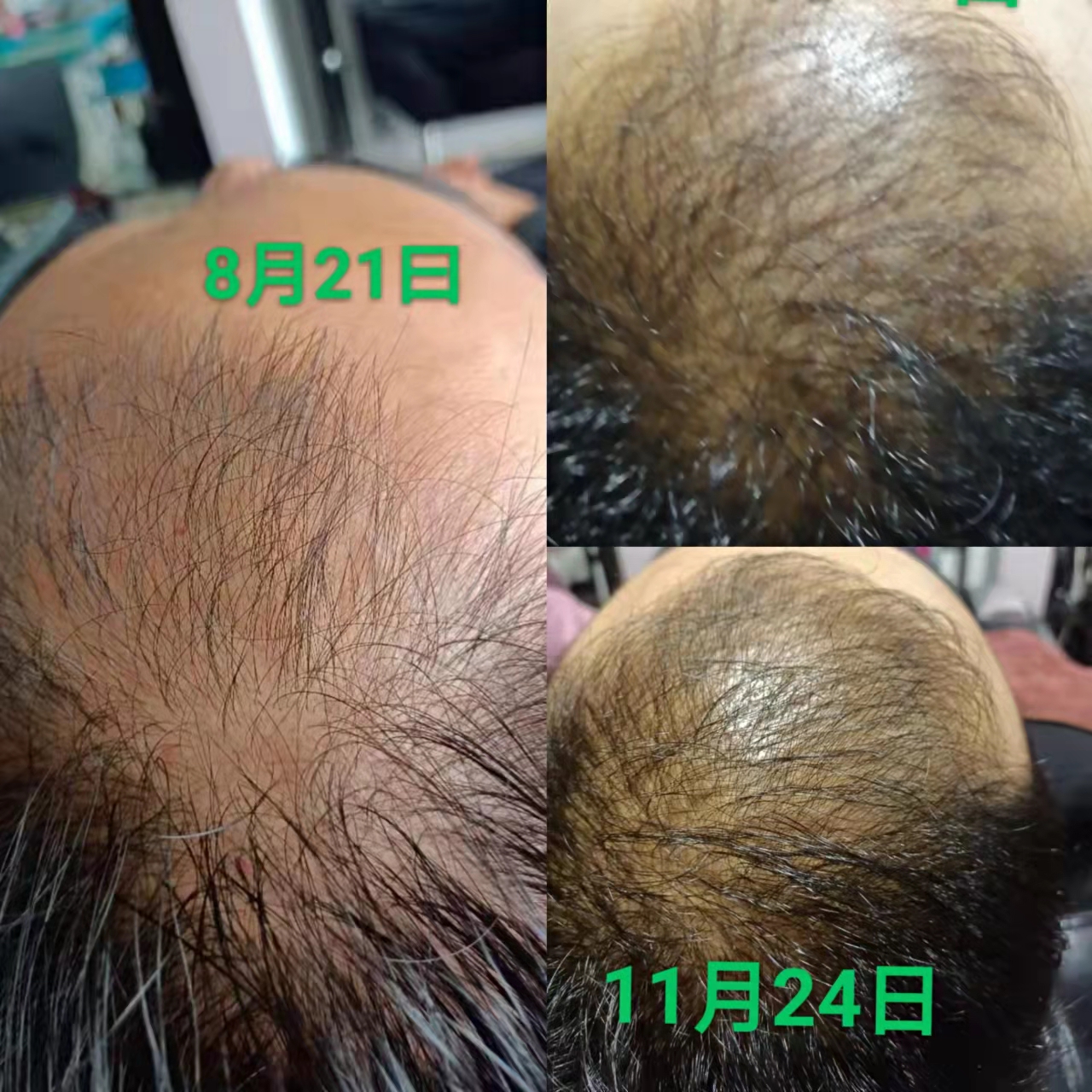 秀丝顿植物染发采用天然植物成分，避免了化学染发剂对头皮和身体的刺激。