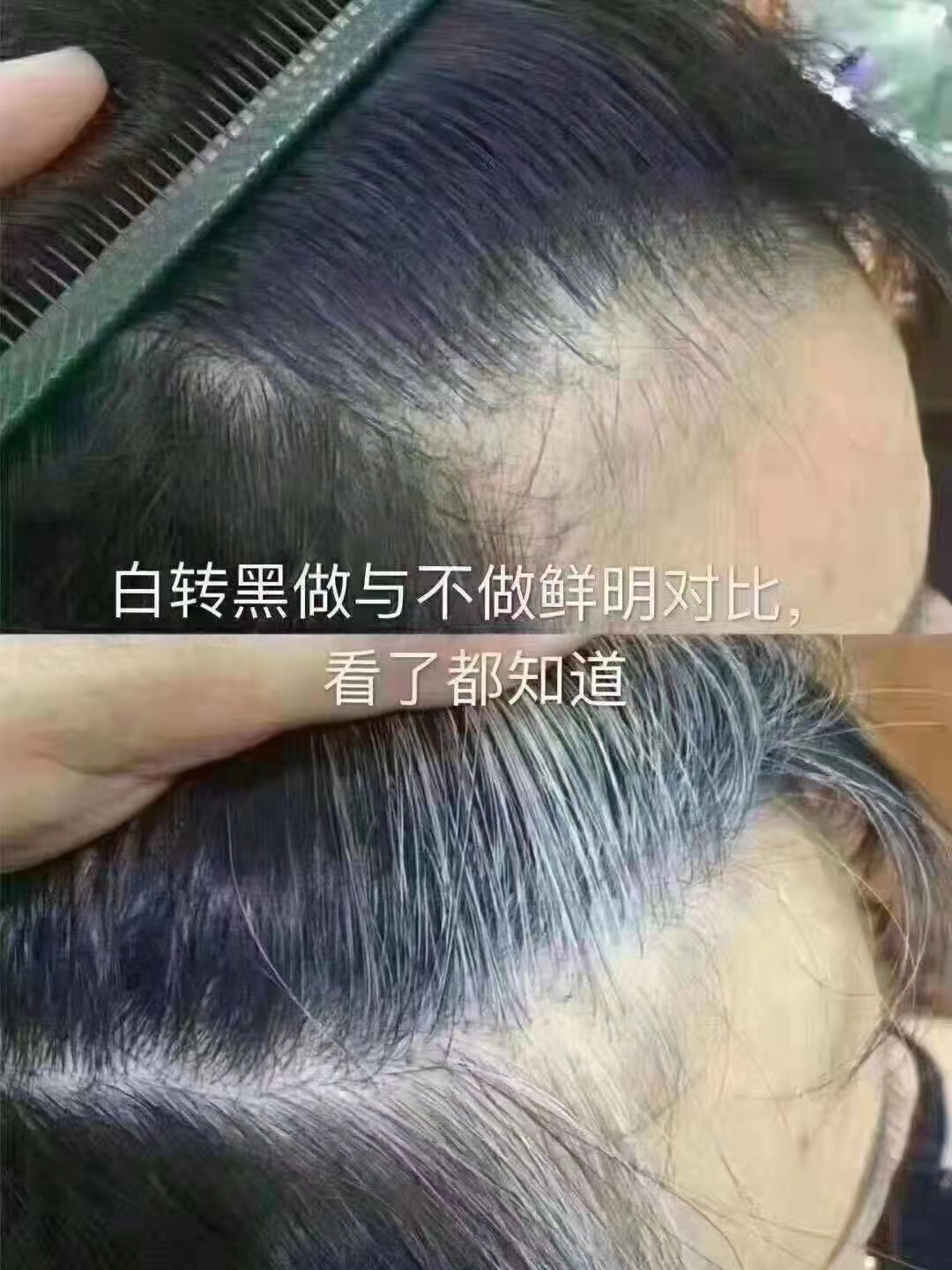 秀丝顿植物养发馆的中药制剂采用了多种天然植物提取物，能够滋养头皮改善白发、防止脱发