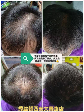 秀丝顿植物养发健康采用纯天然的植物成分，不含硅油、矿物油等化学成分