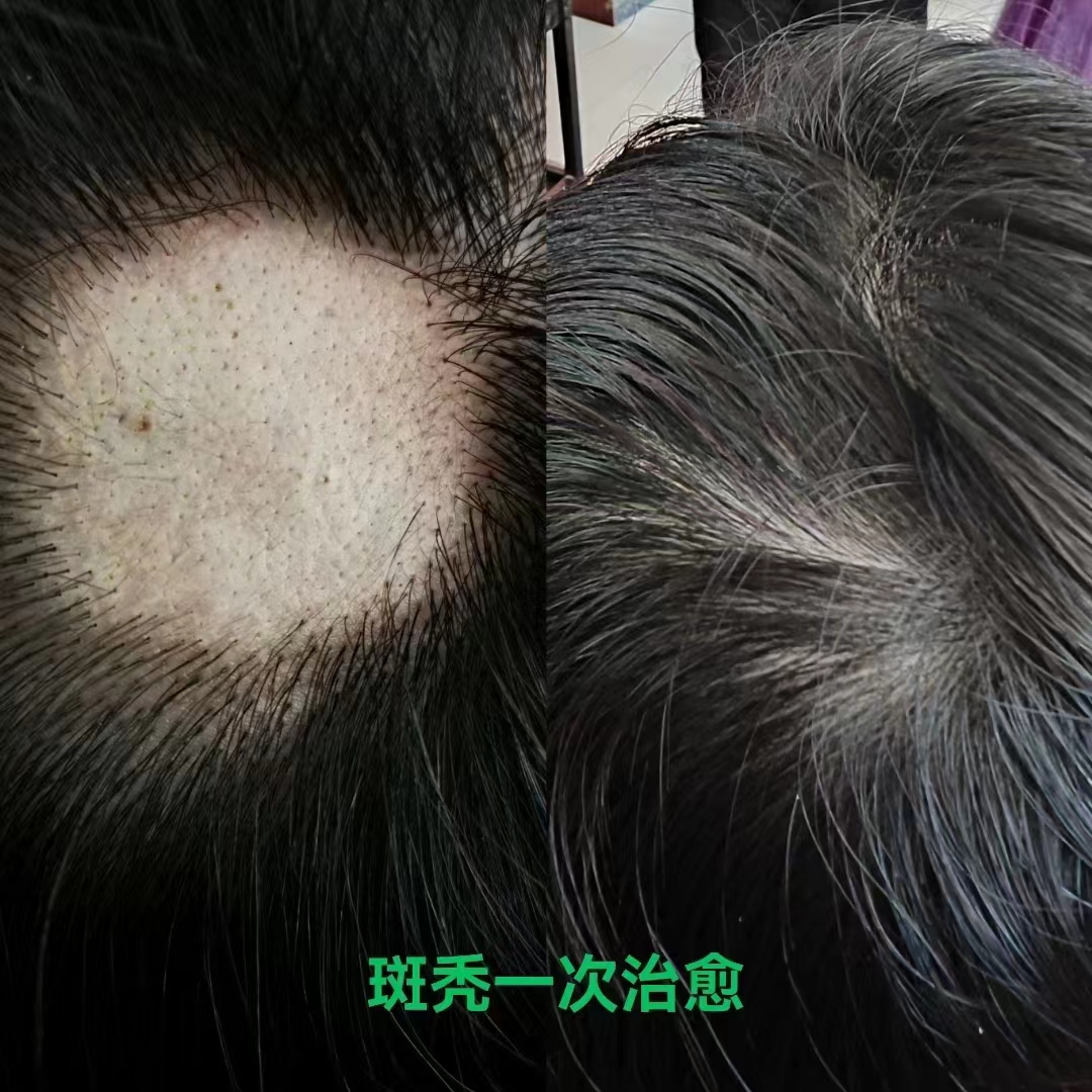 秀丝顿植物养发健康时尚是一种以天然植物为主要成分的头发染发方法。