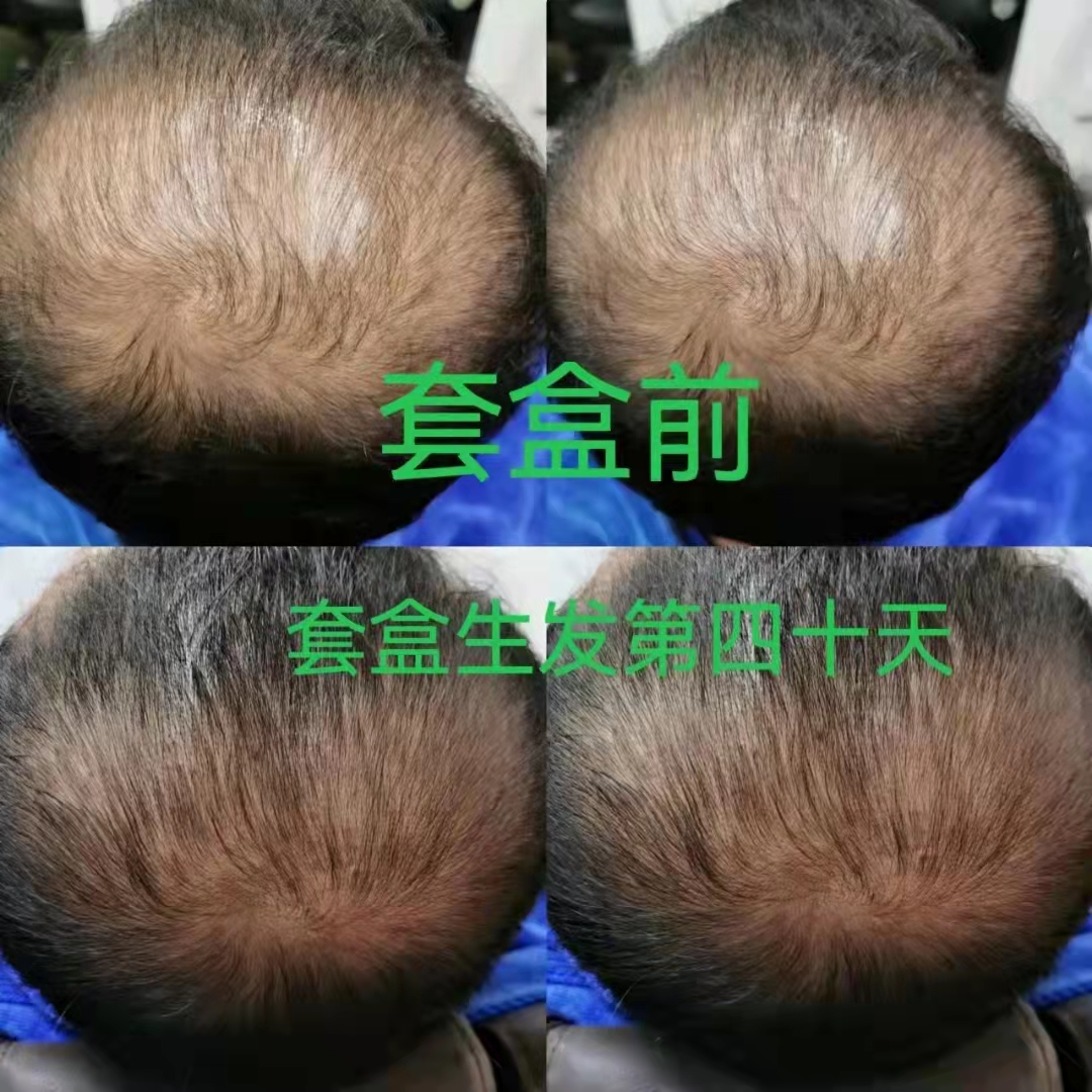 秀丝顿植物养发促进头发生长、减少脱发等问题