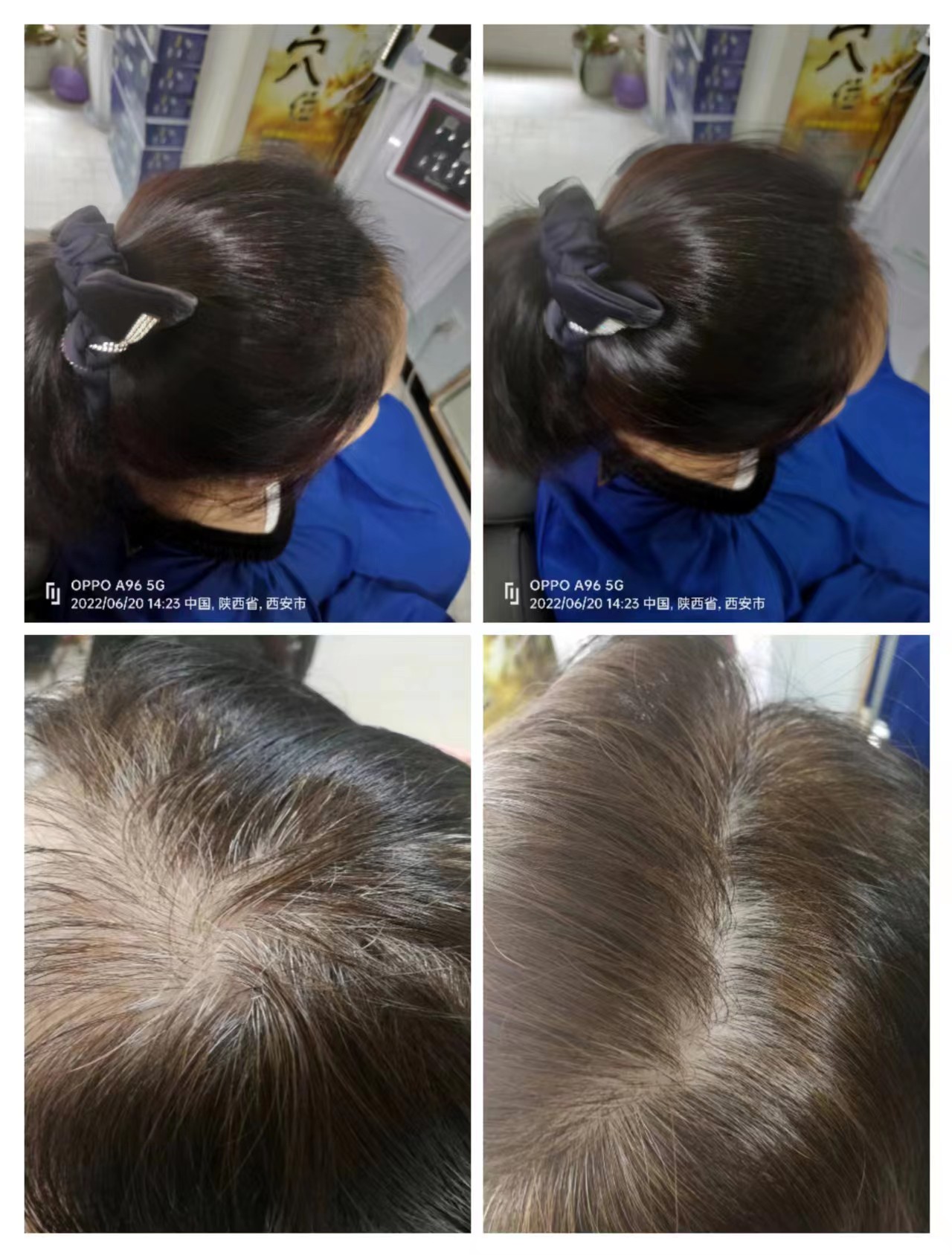 秀丝顿植物养发是一种安全、高效、无刺激的养发产品