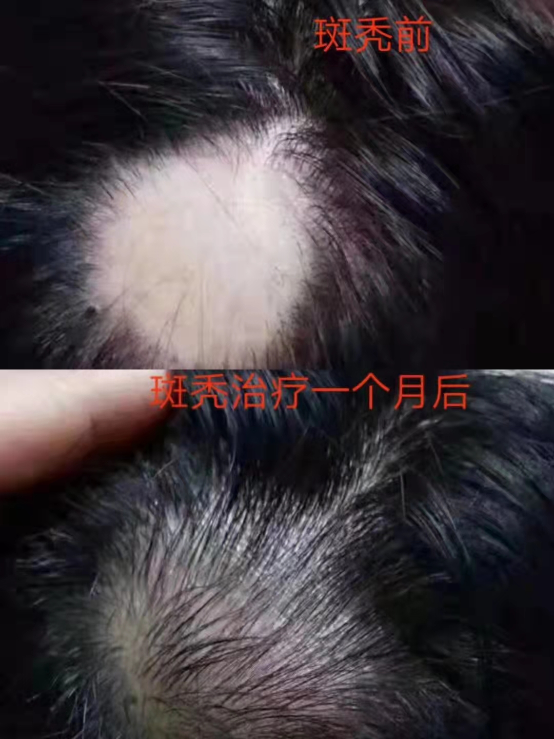 秀丝顿植物养发是一种非常出色的养发产品。它能够有效地解决你的白发问题