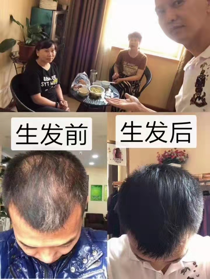 秀丝顿养发头疗可以放松心情，改善人的整个精神状态