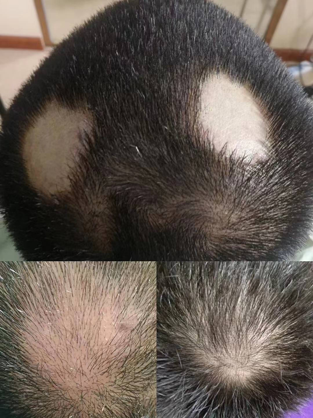 秀丝顿植物养发是一种安全、高效、无刺激的养发产品