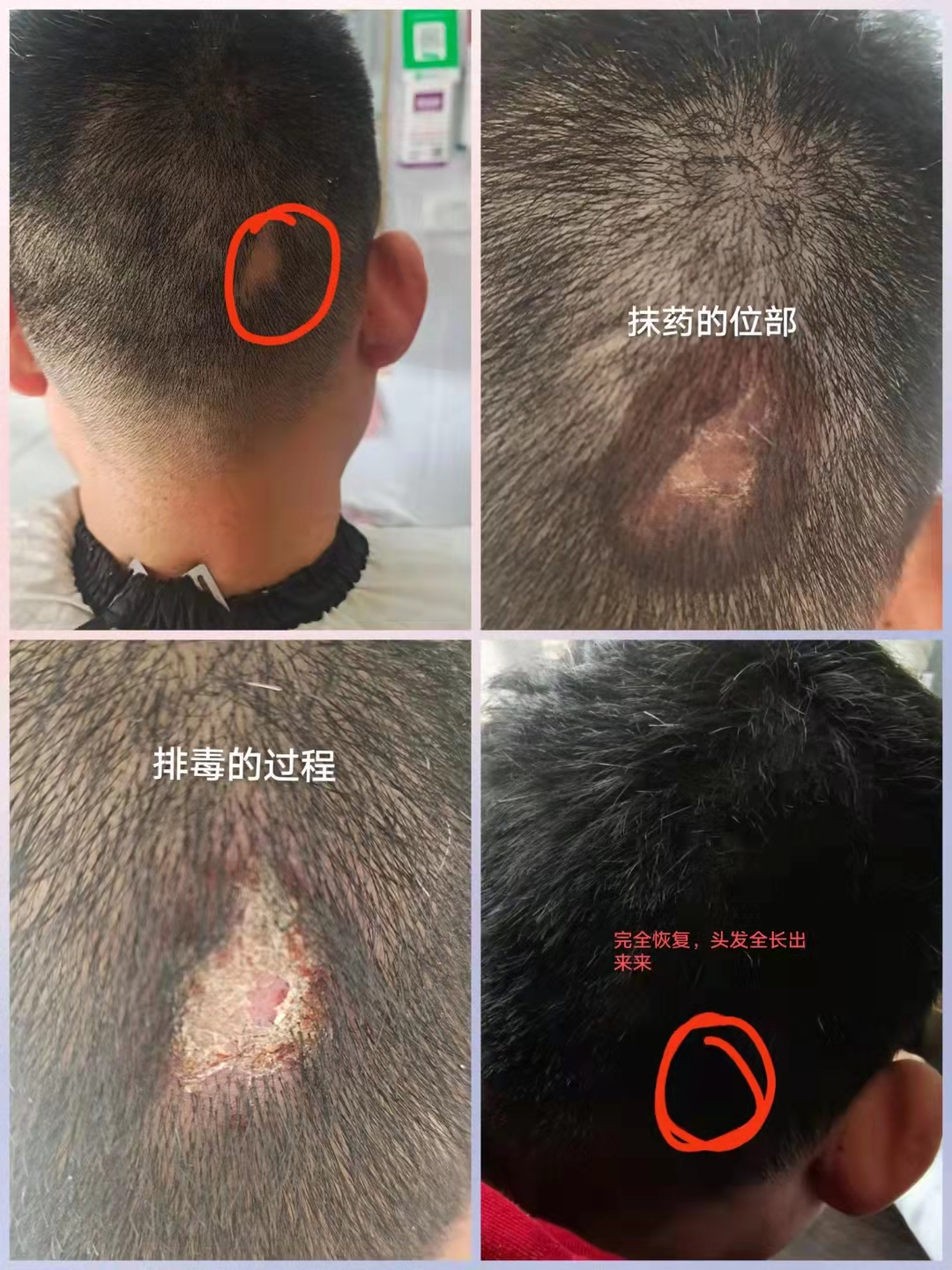 秀丝顿的产品是一种高效、健康的选择，让你的白发从根部自然变黑。