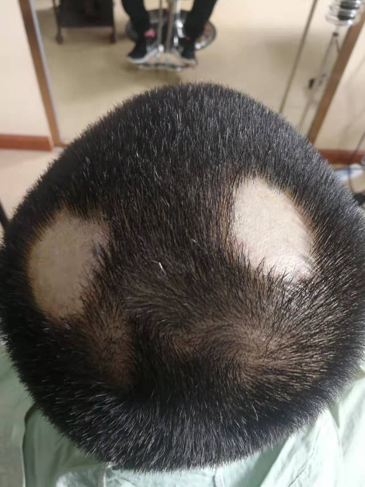 秀丝顿纯植物养发产品。有效地滋养头皮和头发，让你的发质更加健康、柔顺