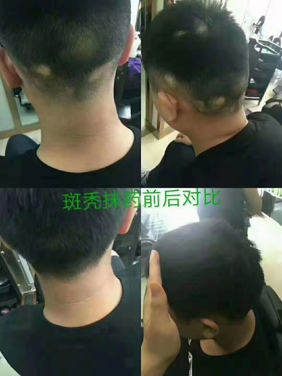 秀丝顿植物染发！让你的美丽不再受到伤害，